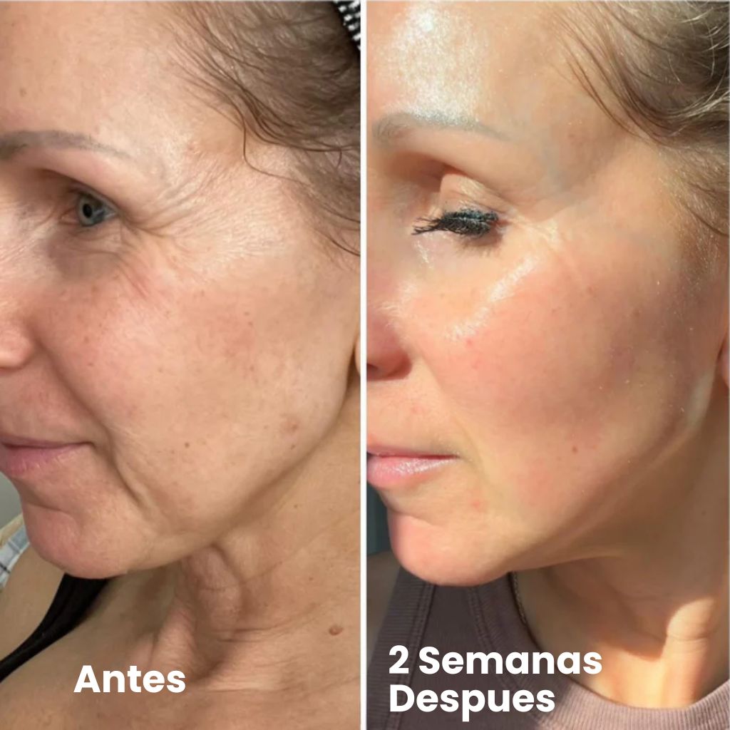 Retinal Shot - Dile Adiós a las Arrugas 😱50% DE DESCUENTO😱